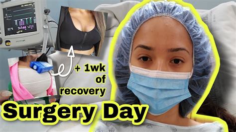 I got a BREAST AUGMENTATION surgery